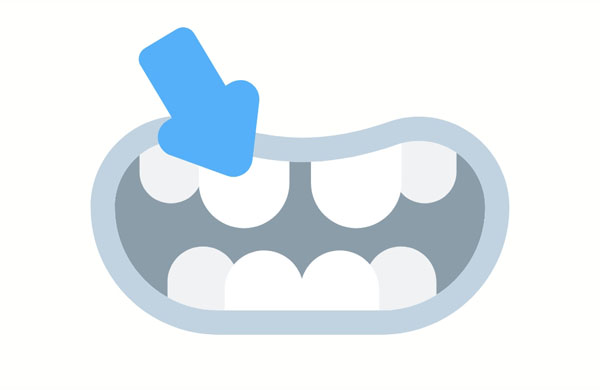 He has a big space between his front teeth.